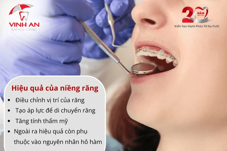Ho-ham-co-nieng-rang-duoc-khong-3