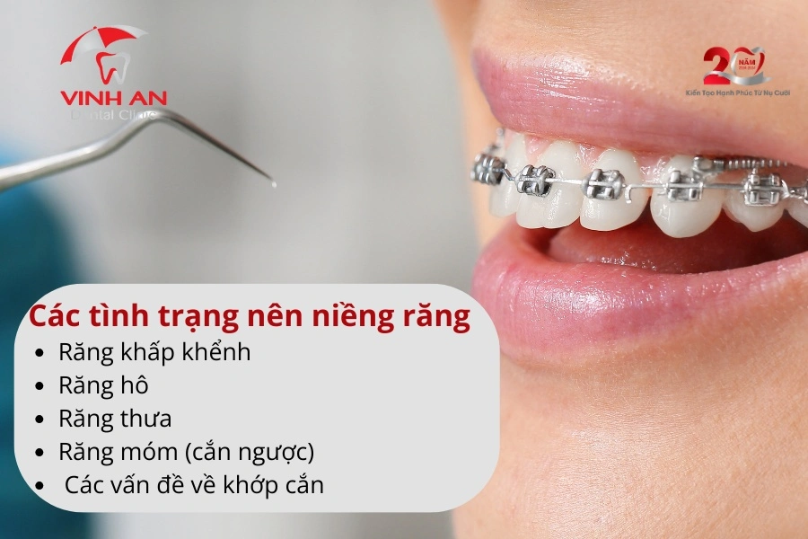 Kinh-nghiem-nieng-rang-1