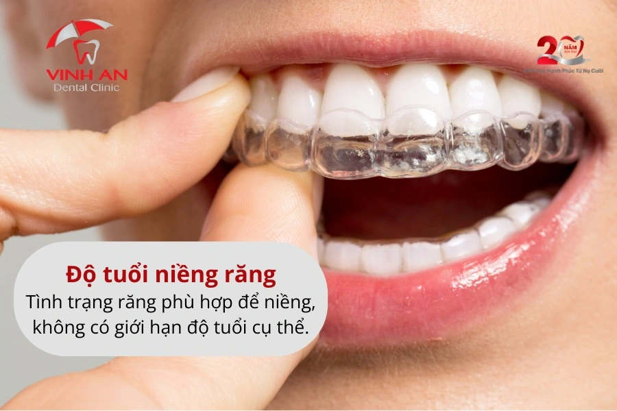 Kinh-nghiem-nieng-rang-2