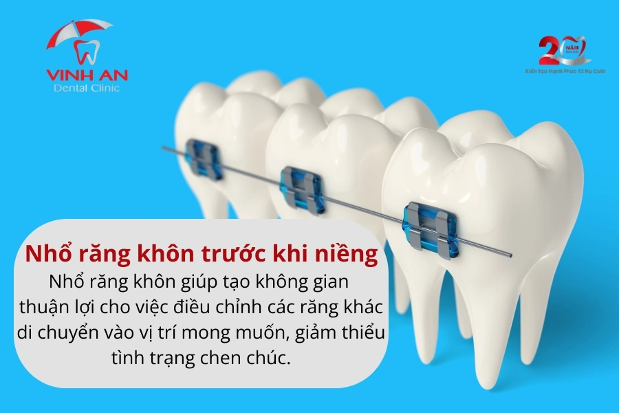 Kinh-nghiem-nieng-rang-3