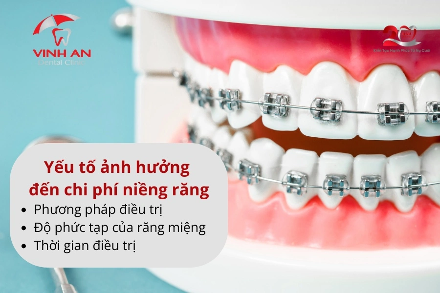 Kinh-nghiem-nieng-rang-7
