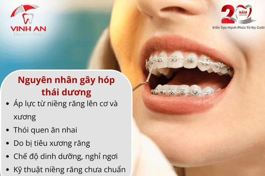 Nieng-rang-bi-hop-thai-duong 2