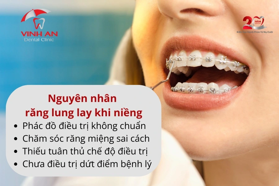 Rang-lung-lay-khi-nieng-_2__1 (1)