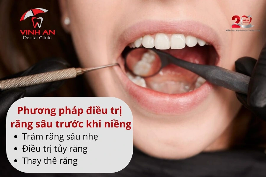 Rang-sau-co-nieng-duoc-khong