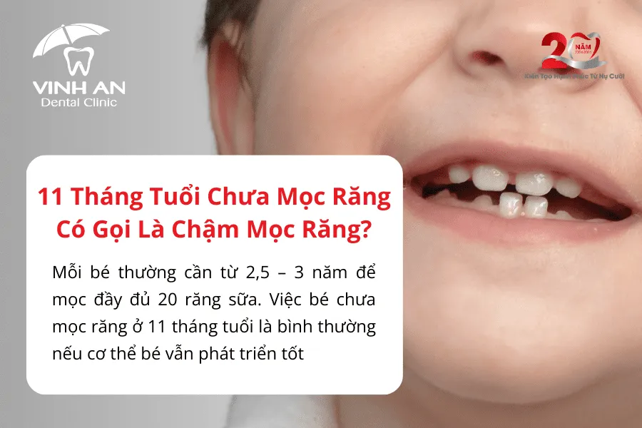 Bé 11 Tuổi Chưa Mọc Răng 2