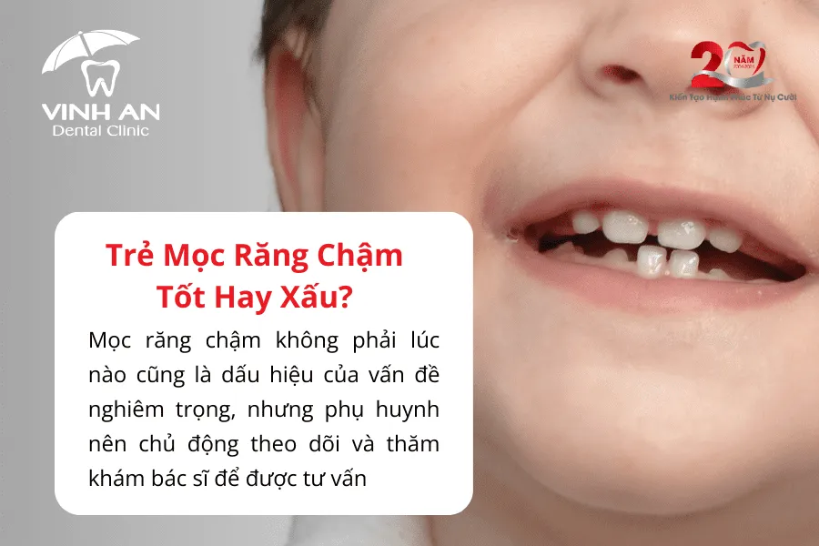 Bé Chậm Mọc Răng Bố Mẹ Giàu 3