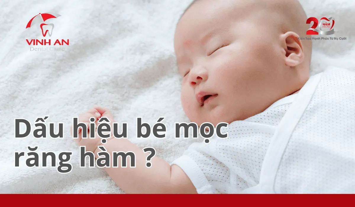 Bé Mọc Răng Hàm