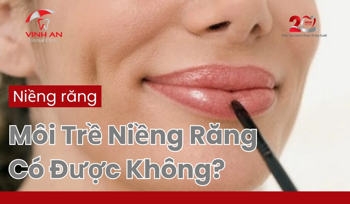 Môi trề niềng răng