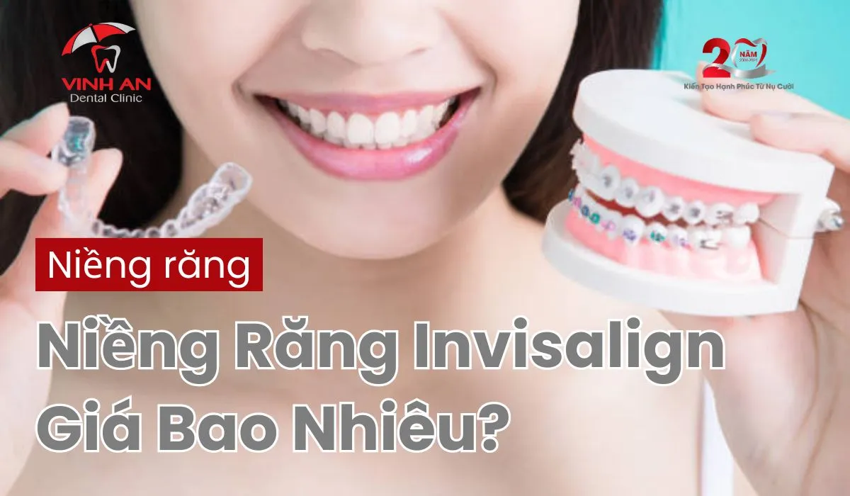 Niềng-răng-invisalign-giá-01