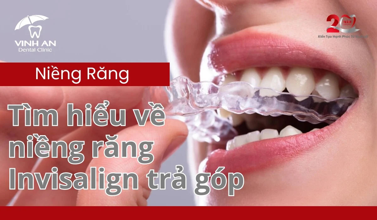 Niềng Răng Invisalign Trả Góp