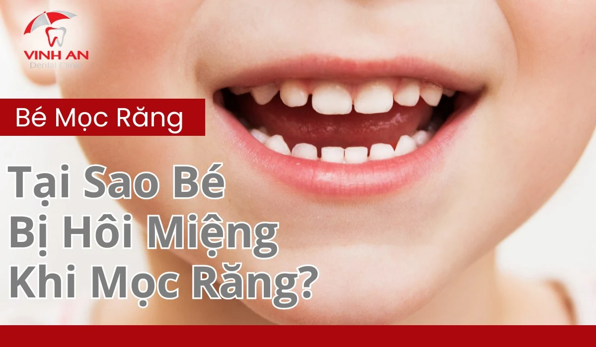 Bé Hôi Miệng Khi Mọc Răng