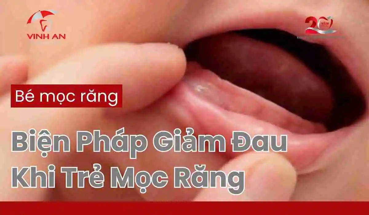 Bé-mọc-răng