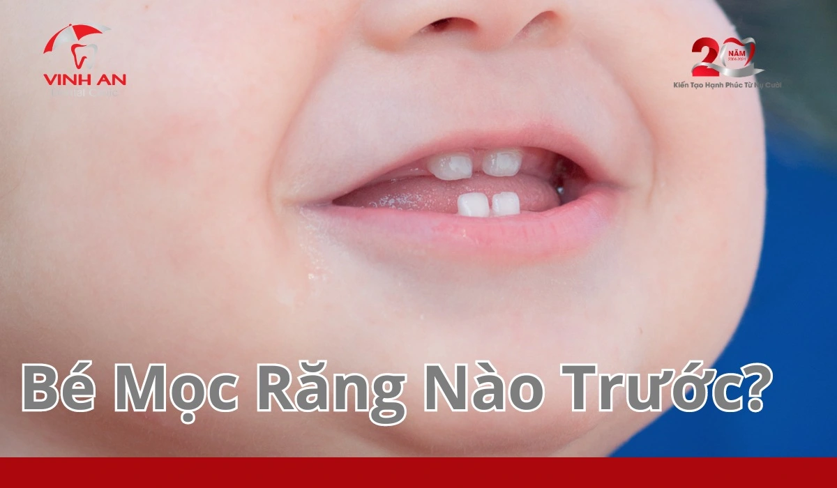 Be-moc-rang-nao-truoc