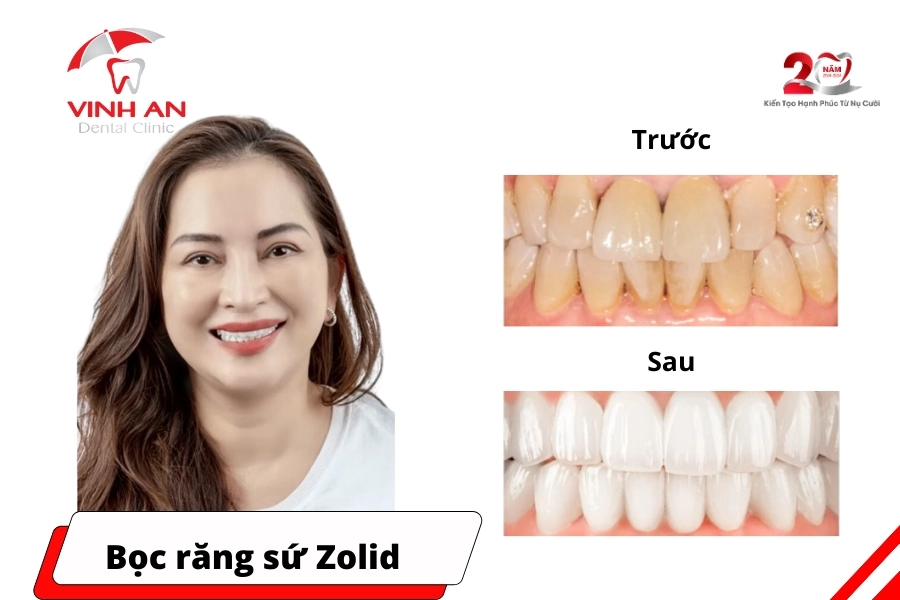 Khach-hang-chi-thao-_1