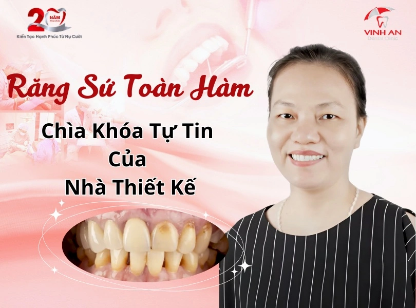 Khách hàng làm răng sứ toàn hàm