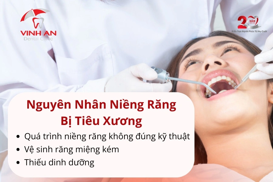Niềng Răng Bị Tiêu Xương