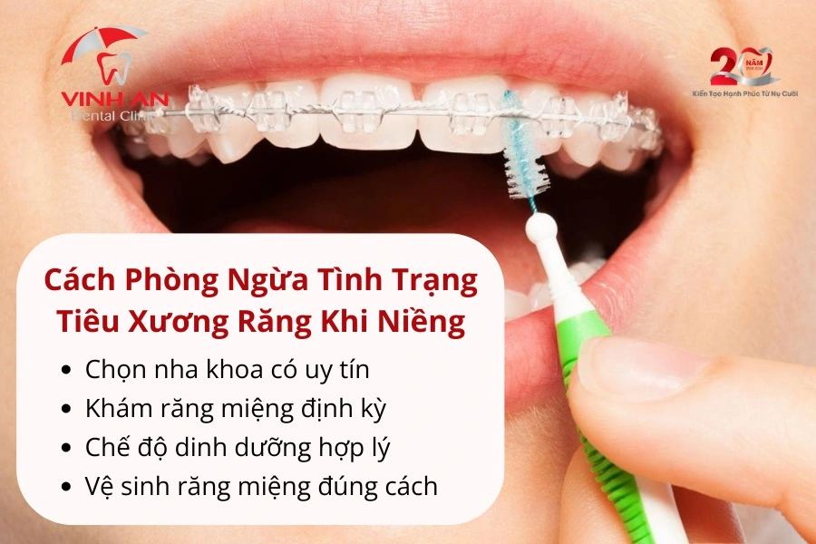 Niềng Răng Bị Tiêu Xương