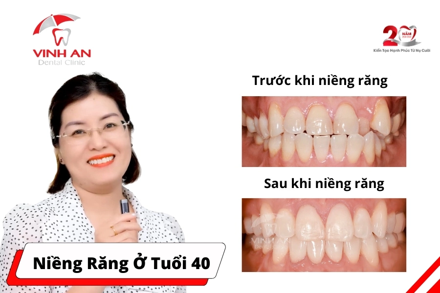 Nieng-rang-tuoi-40-thumbnail