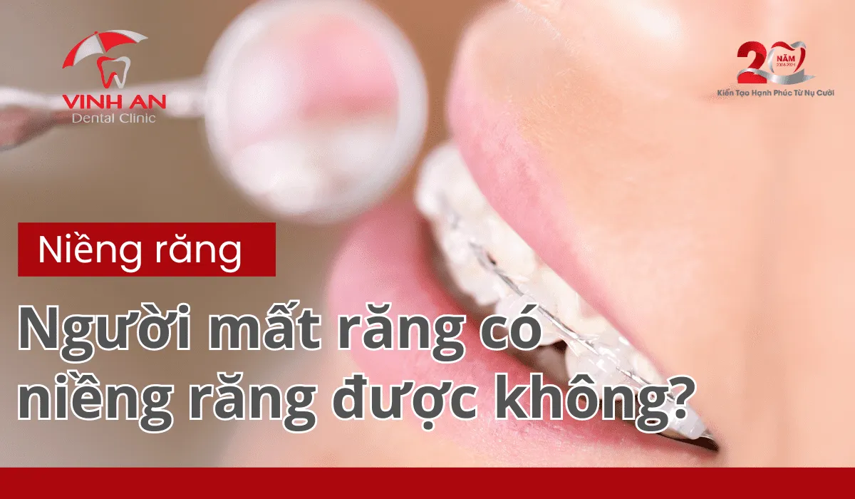 Mất Răng Có Niềng Răng được Không