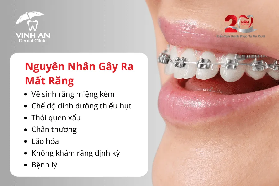 Mất Răng Có Niềng Răng được Không2