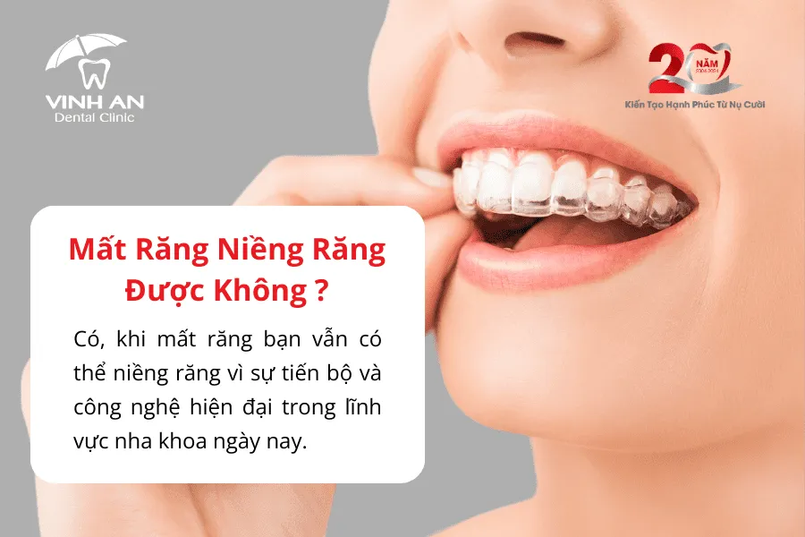 Mất Răng Có Niềng Răng được Không3