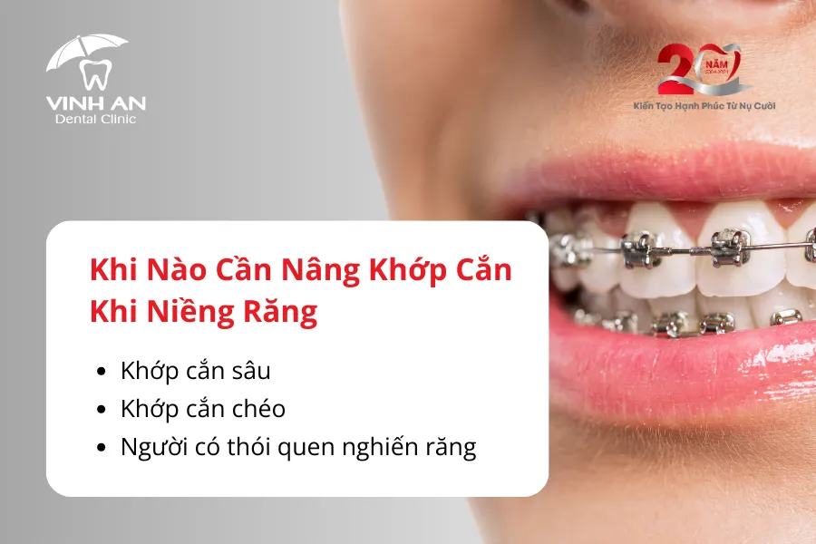 Nâng Khớp Cắn Trong Niềng Răng2