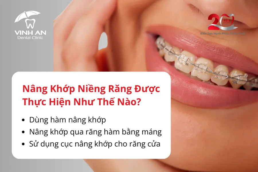 Nâng Khớp Cắn Trong Niềng Răng3