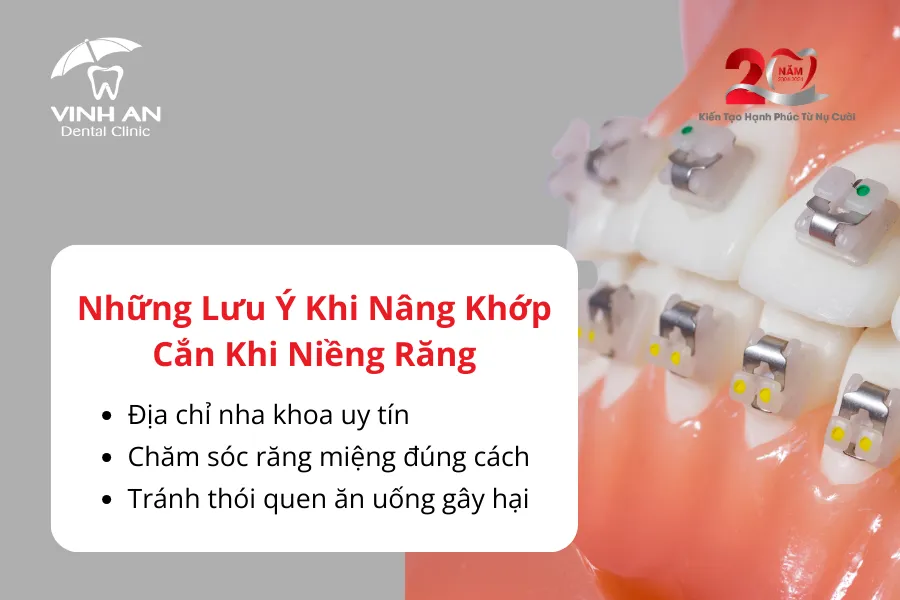 Nâng Khớp Cắn Trong Niềng Răng6