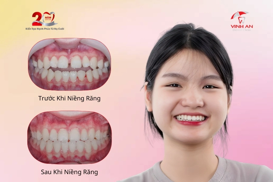 Cau-chuyen-khach-hang-thao