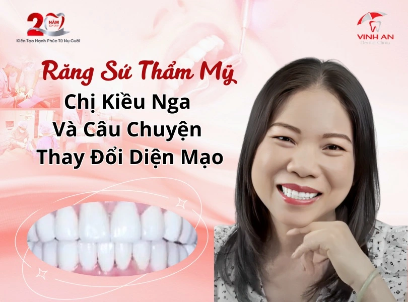 Chi-kieu-nga