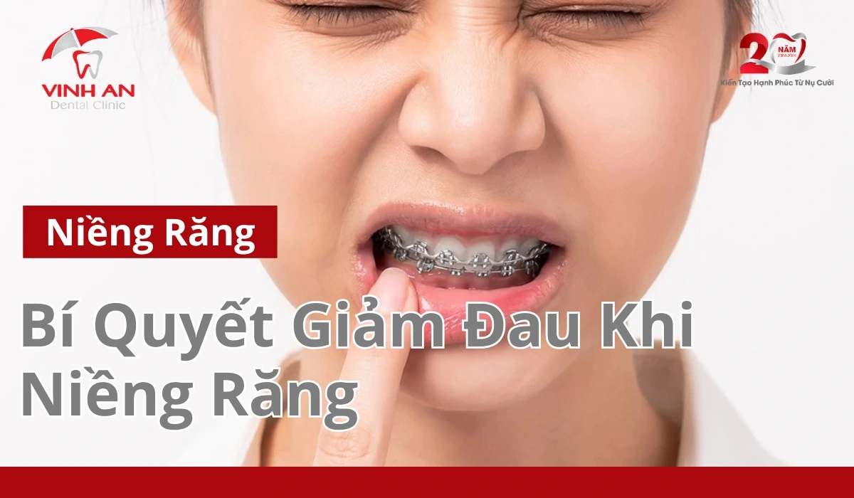 Giảm đau khi niềng răng