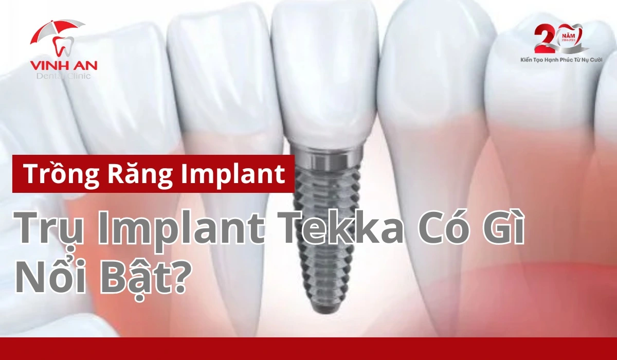 implant tekka