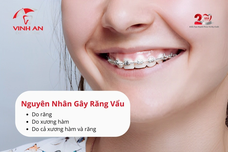 Nieng-rang-vau-_2_