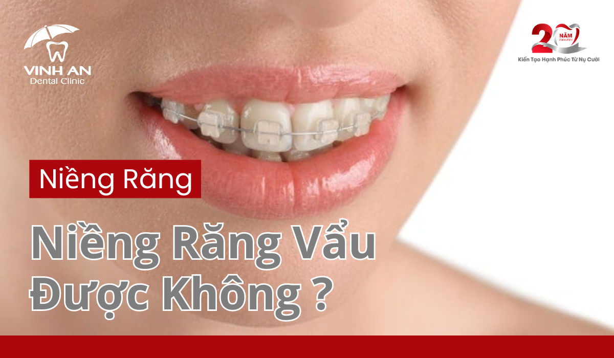 Nieng-rang-vau-duoc-khong