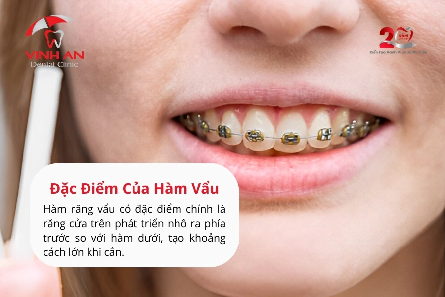 Nieng-rang-vau_1_