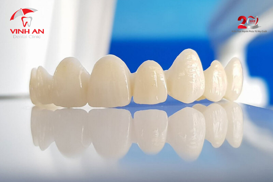 Trong-rang-implant-cho-nguoi-cao-tuoi (5)