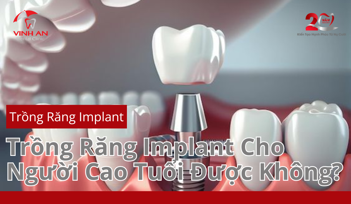 Trong-rang-implant-cho-nguoi-cao-tuoi