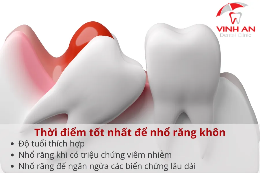 "Tín hiệu vũ trụ" để bạn cân nhắc nhổ răng đúng thời điểm