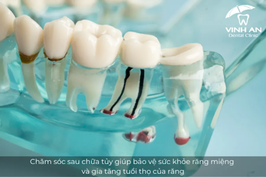 Cham-soc-sau-khi-chua-tuy-1