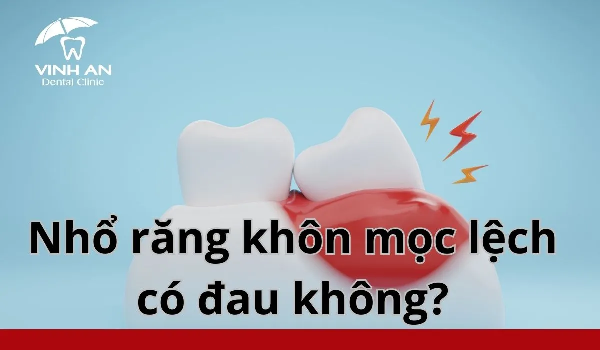 Nho-rang-khon-moc-lech-12