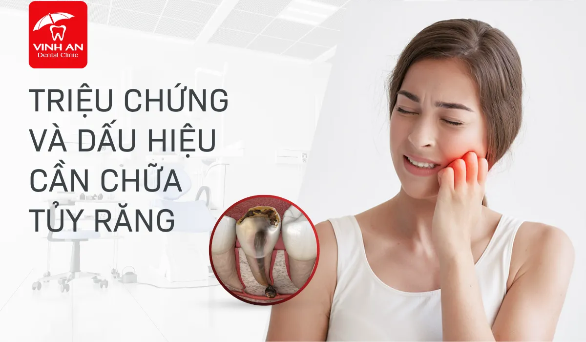 Thumbnail-viem-tuy-rang