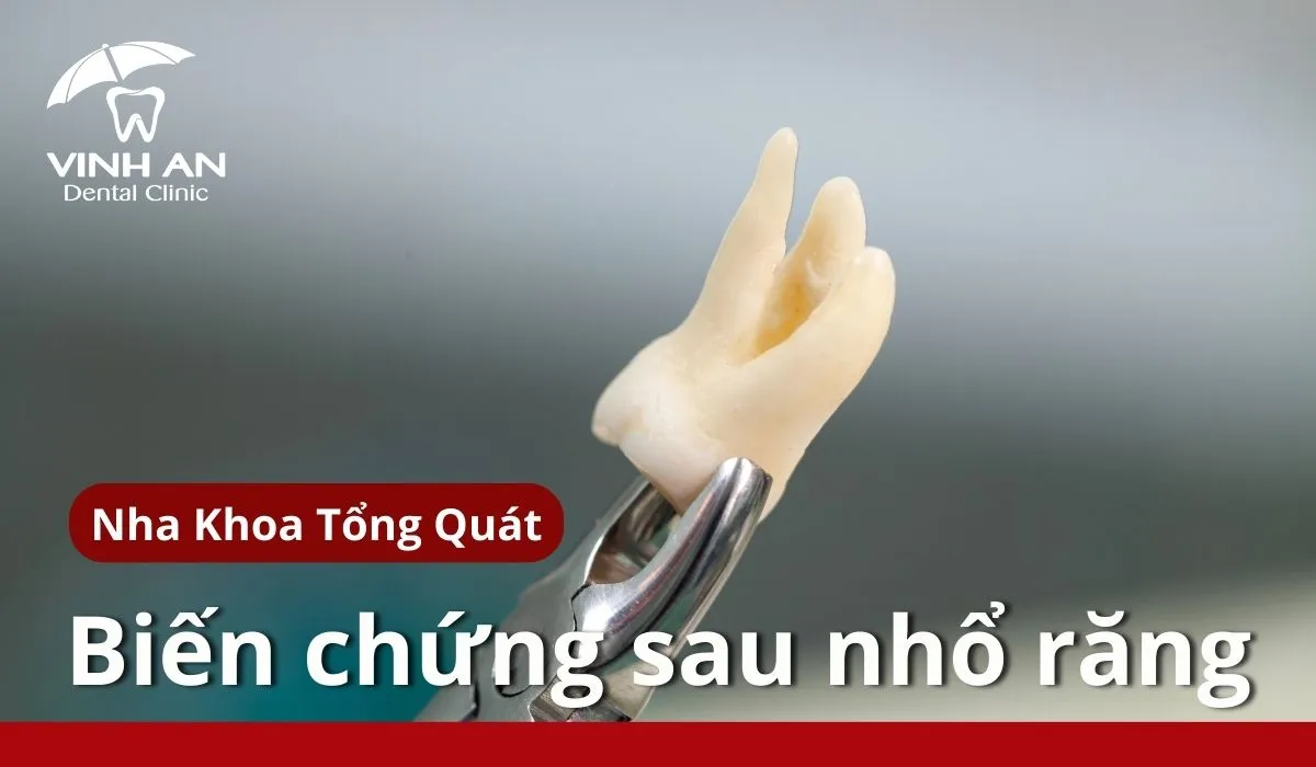 Bien-chung-sau-khi-nho-rang-10