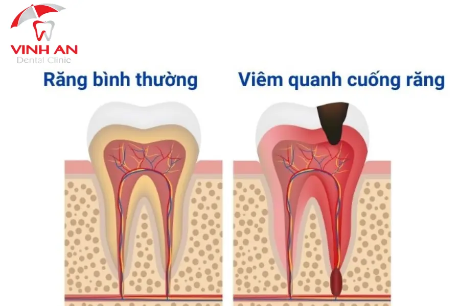 bien-chung-sau-chua-tuy-rang (5)
