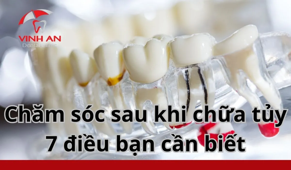 Cham-soc-sau-khi-chua-tuy-8
