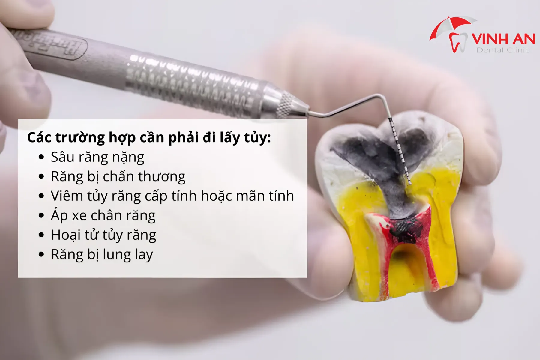 Lay-tuy-rang (2)