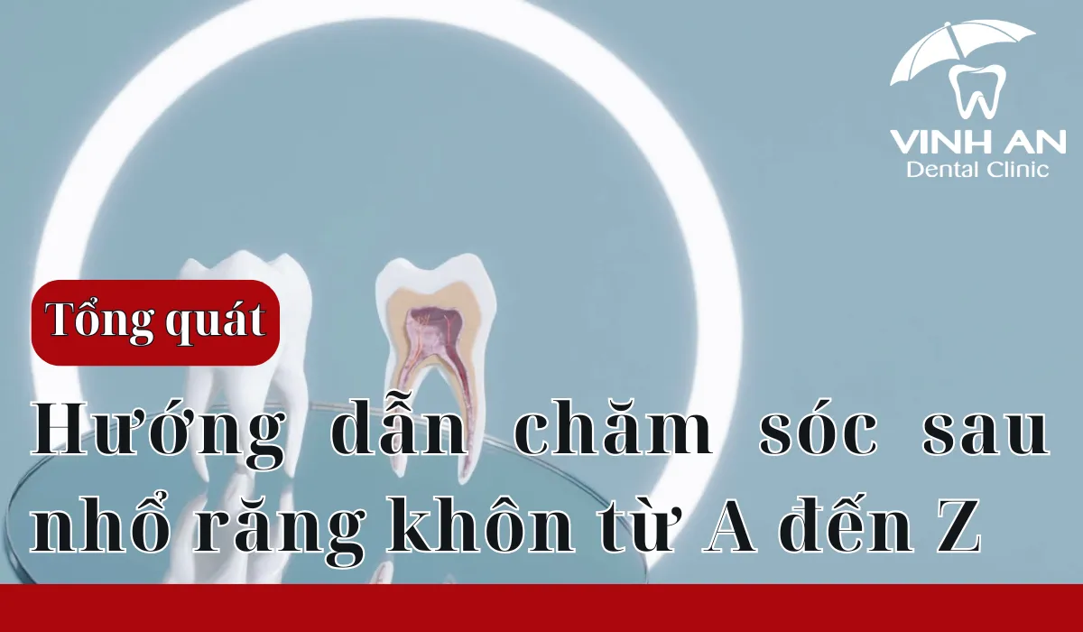 Hướng Dẫn Chăm Sóc Sau Nhổ Răng Khôn Từ A đến Z
