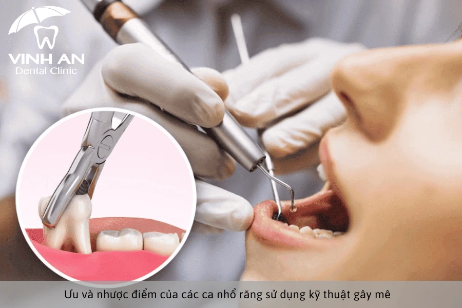 Ưu và nhược điểm của kỹ thuật gây mê