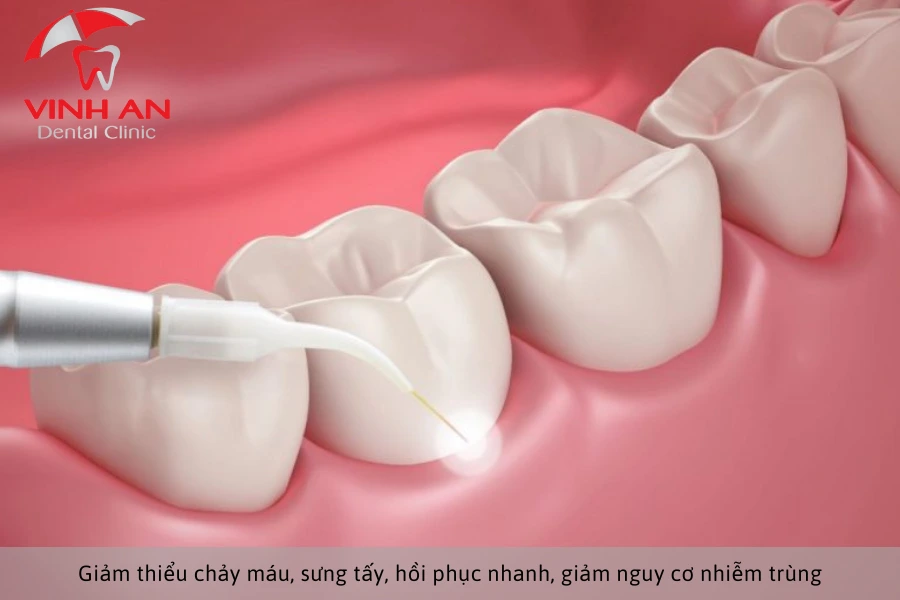 Phuong-phap-nho-rang-khon (5)