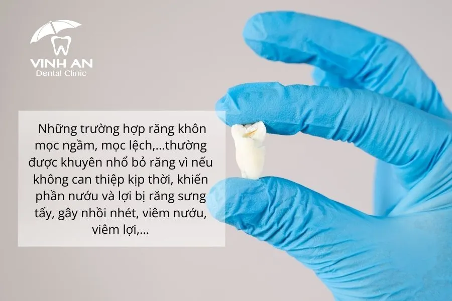 Can thiệp nhổ răng khôn kịp thời để tránh biến chứng