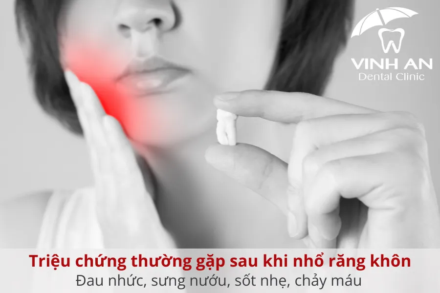 Một số triệu chứng sau khi nhổ răng khôn như đau, sưng, sốt nhẹ